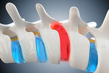 A 3d rendering of a human spine